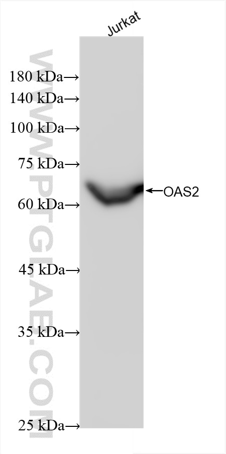 Western Blot (WB) analysis of various lysates using OAS2 Recombinant antibody (82758-2-RR)