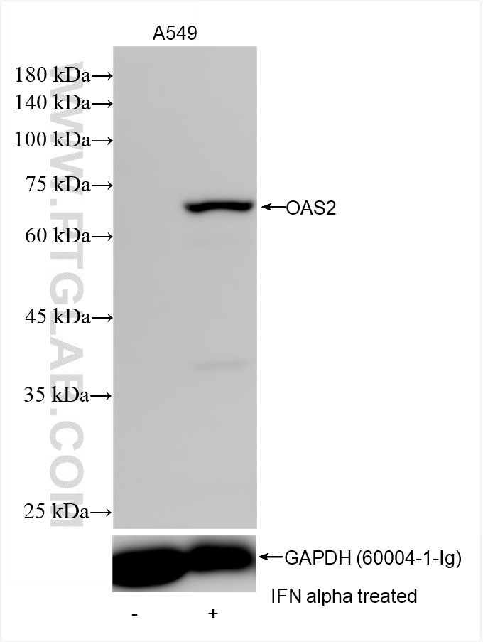 Western Blot (WB) analysis of various lysates using OAS2 Recombinant antibody (82758-2-RR)