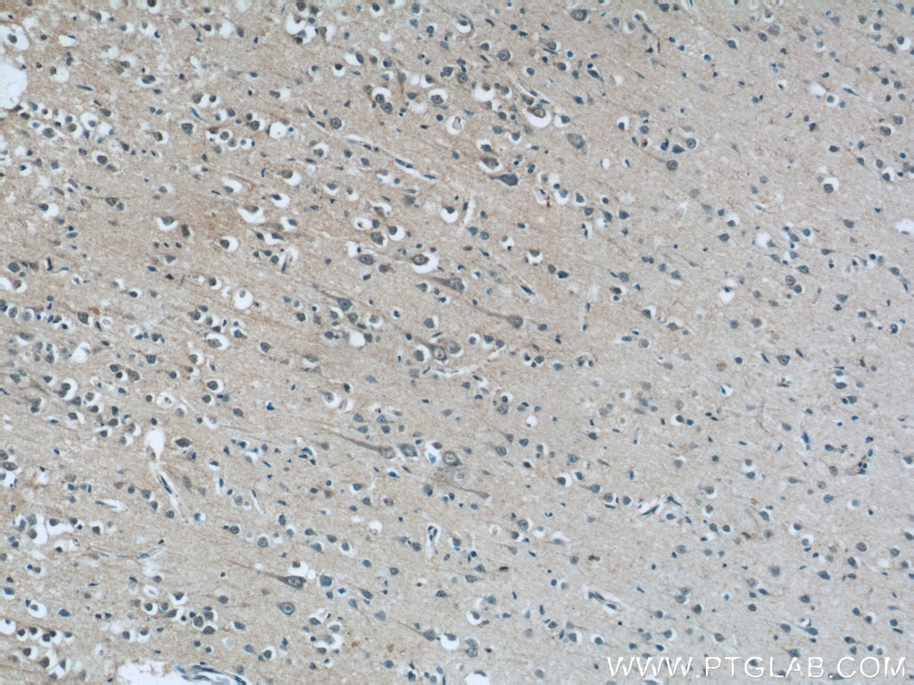 Immunohistochemistry (IHC) staining of human brain tissue using OAS3 Polyclonal antibody (21915-1-AP)