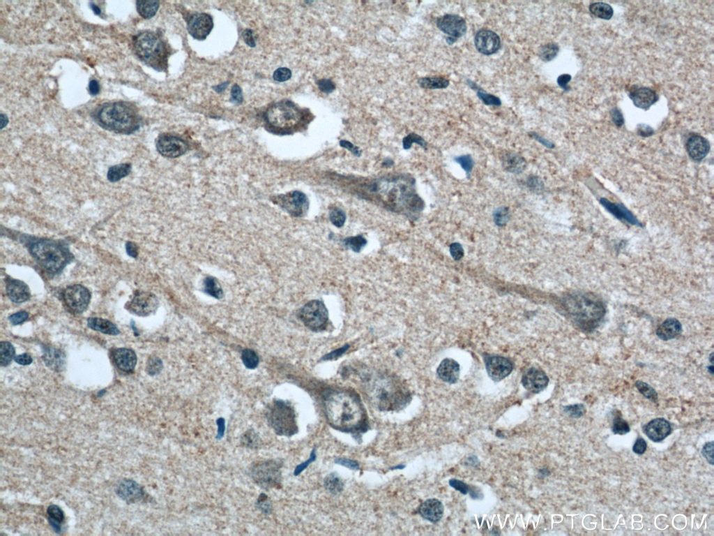 Immunohistochemistry (IHC) staining of human brain tissue using OAS3 Polyclonal antibody (21915-1-AP)