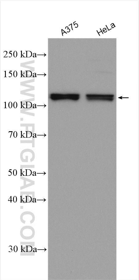 Western Blot (WB) analysis of various lysates using OAS3 Polyclonal antibody (21915-1-AP)