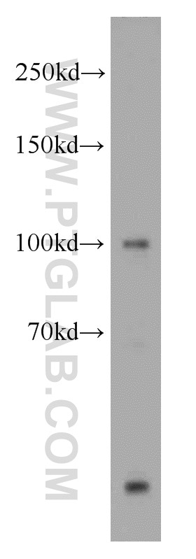 Western Blot (WB) analysis of HeLa cells using OAS3 Polyclonal antibody (21915-1-AP)