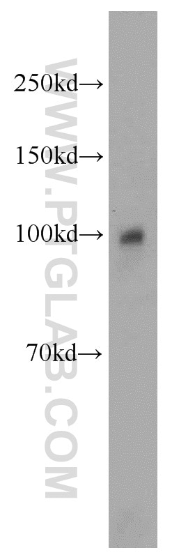 Western Blot (WB) analysis of A375 cells using OAS3 Polyclonal antibody (21915-1-AP)
