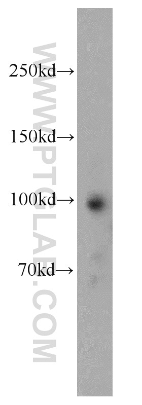 Western Blot (WB) analysis of human placenta tissue using OAS3 Polyclonal antibody (21915-1-AP)