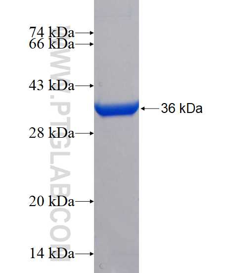 OAS3 fusion protein Ag17411 SDS-PAGE