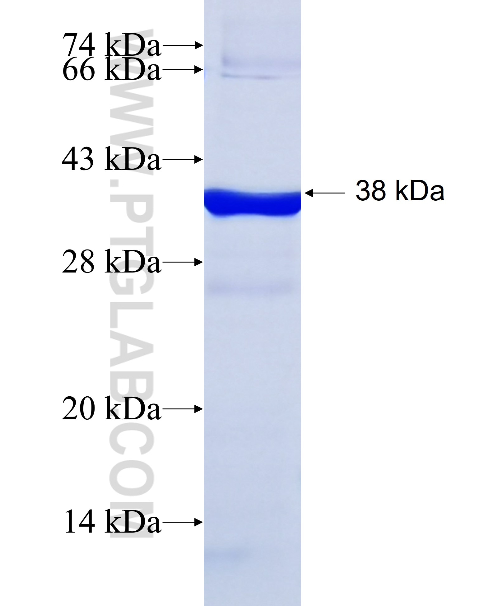 OAS3 fusion protein Ag17411 SDS-PAGE