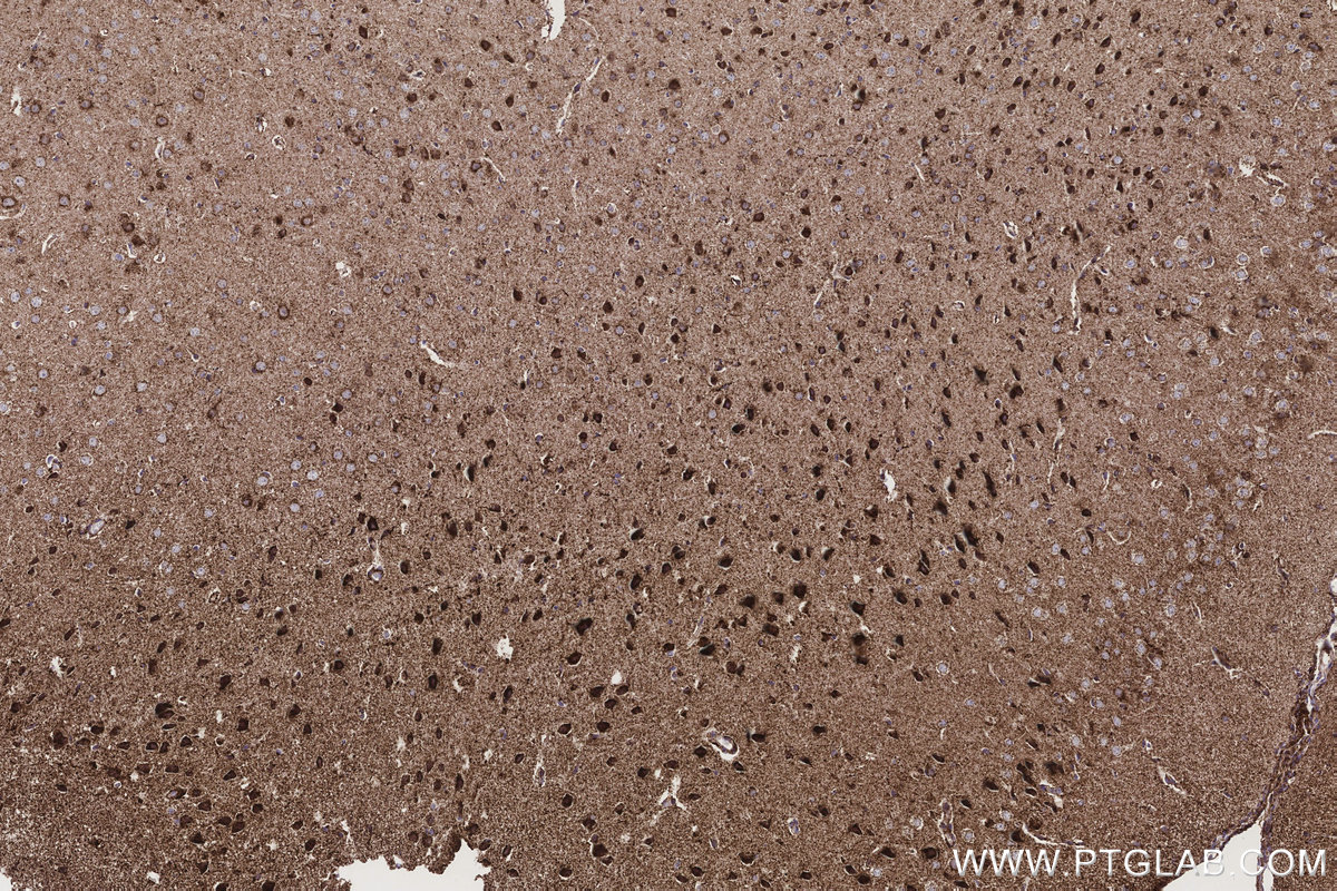 Immunohistochemistry (IHC) staining of mouse brain tissue using OAT Recombinant monoclonal antibody (85218-2-RR)
