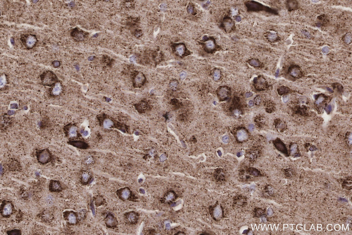 Immunohistochemistry (IHC) staining of rat brain tissue using OAT Recombinant monoclonal antibody (85218-2-RR)
