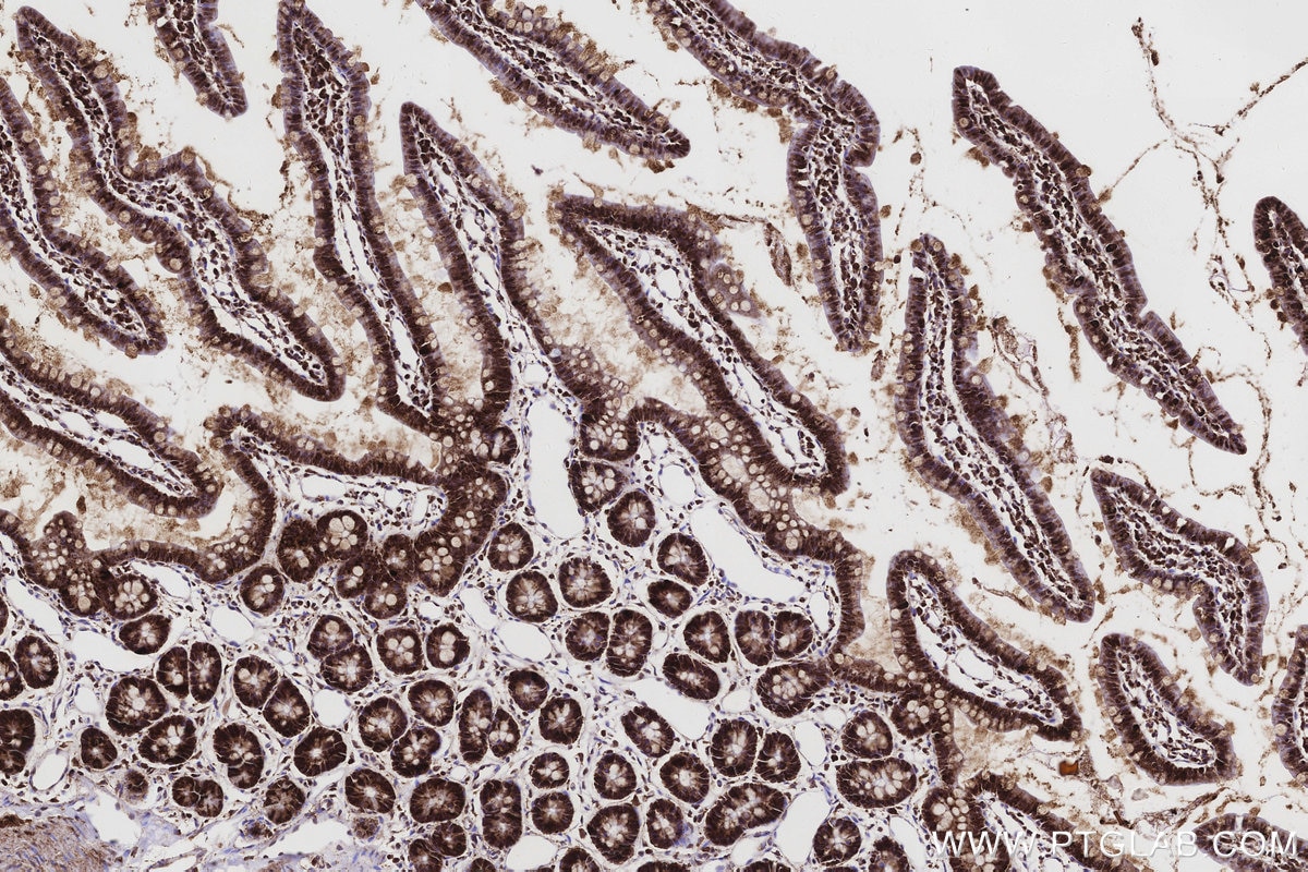Immunohistochemistry (IHC) staining of rat small intestine tissue using OAT Recombinant monoclonal antibody (85218-2-RR)