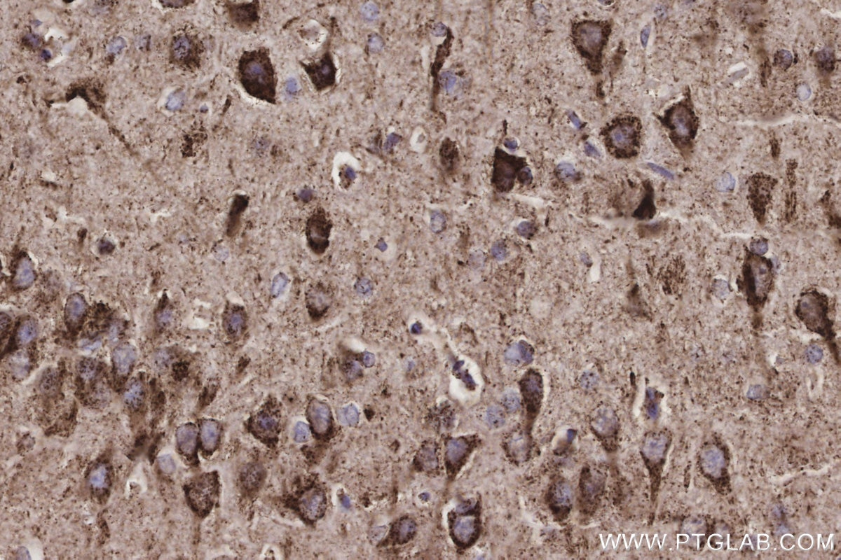 Immunohistochemistry (IHC) staining of rat brain tissue using OAT Recombinant monoclonal antibody (85218-2-RR)