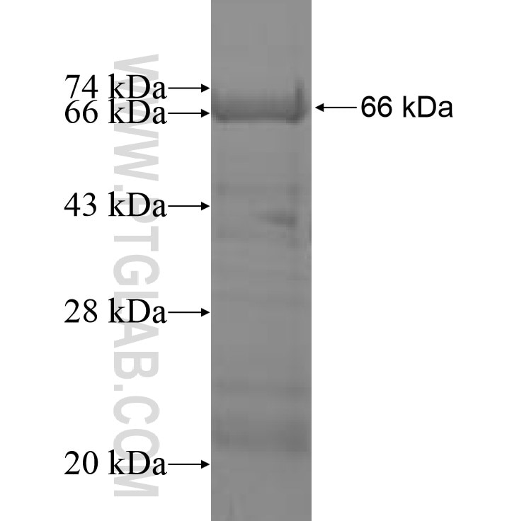 OAT fusion protein Ag9981 SDS-PAGE