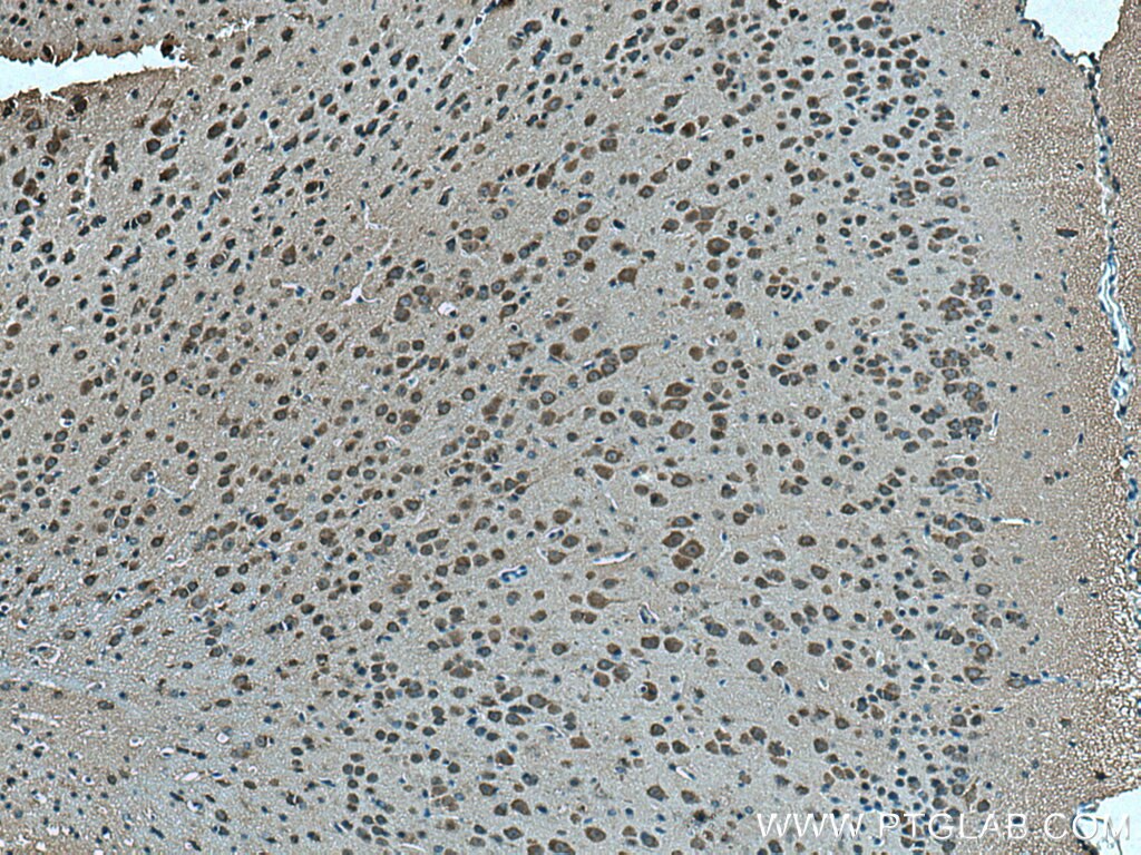 Immunohistochemistry (IHC) staining of mouse brain tissue using OAT1 Polyclonal antibody (26574-1-AP)