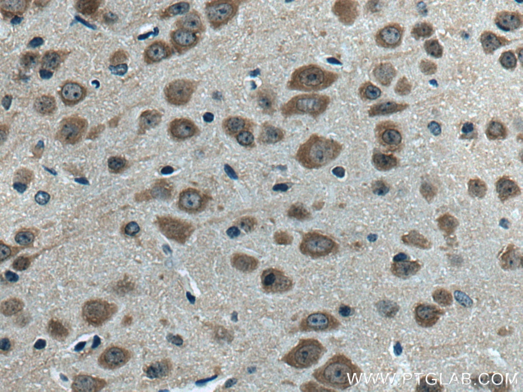 Immunohistochemistry (IHC) staining of mouse brain tissue using OAT1 Polyclonal antibody (26574-1-AP)