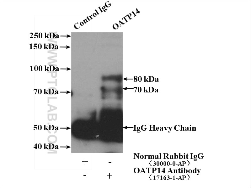 Immunoprecipitation (IP) experiment of mouse brain tissue using OATP14 Polyclonal antibody (17163-1-AP)