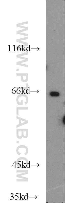 Western Blot (WB) analysis of PC-3 cells using OATP14 Polyclonal antibody (17163-1-AP)