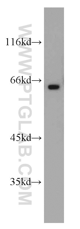 Western Blot (WB) analysis of mouse brain tissue using OATP14 Polyclonal antibody (17163-1-AP)