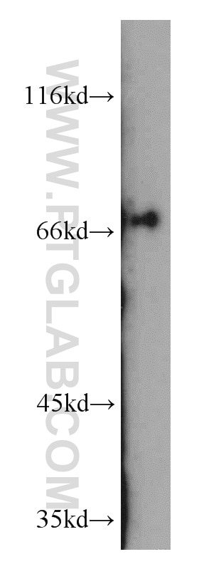 Western Blot (WB) analysis of mouse kidney tissue using OATP14 Polyclonal antibody (17163-1-AP)