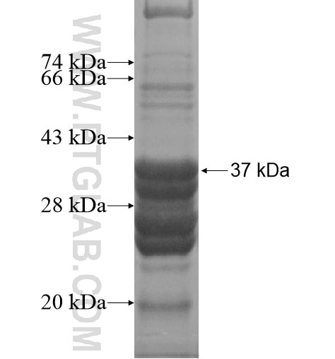 OATP14 fusion protein Ag10573 SDS-PAGE