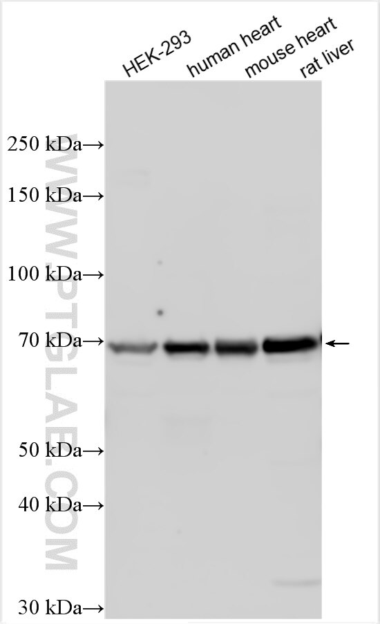 Western Blot (WB) analysis of various lysates using OATP1A2 Polyclonal antibody (31626-1-AP)