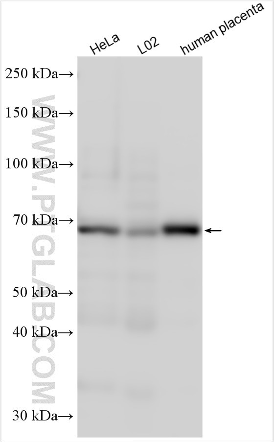 Western Blot (WB) analysis of various lysates using OATP1B3 Polyclonal antibody (22815-1-AP)