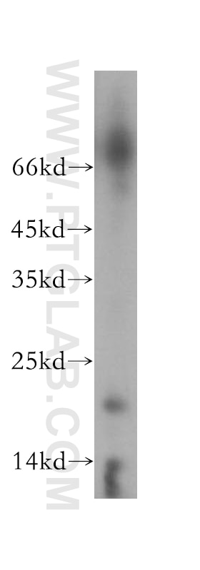 Western Blot (WB) analysis of COLO 320 cells using OBFC2A Polyclonal antibody (16719-1-AP)