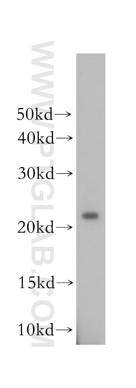 Western Blot (WB) analysis of COLO 320 cells using OBFC2A Polyclonal antibody (16719-1-AP)