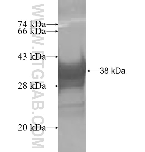 OBFC2A fusion protein Ag10158 SDS-PAGE