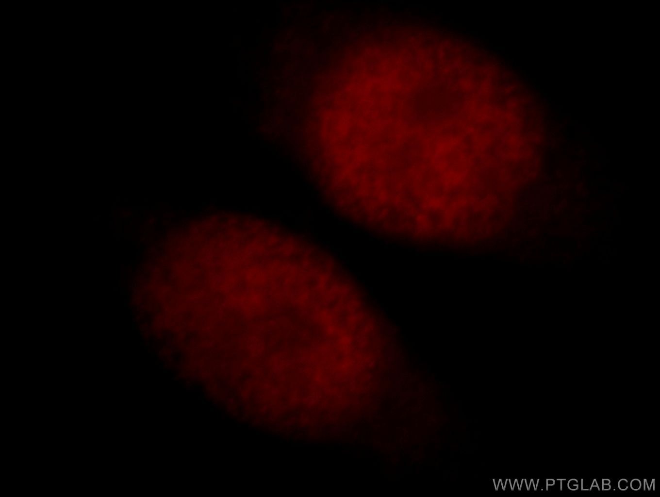 IF Staining of HeLa using 14809-1-AP