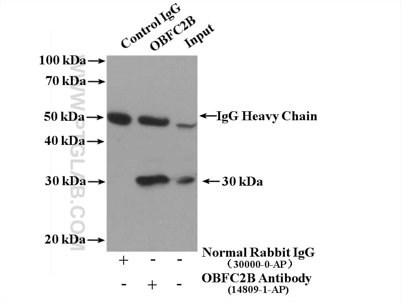 Immunoprecipitation (IP) experiment of HeLa cells using OBFC2B Polyclonal antibody (14809-1-AP)