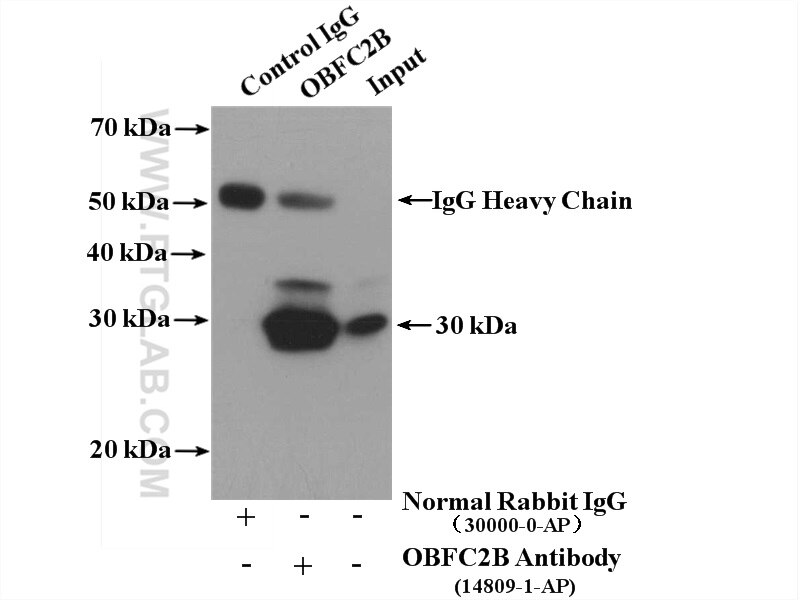 Immunoprecipitation (IP) experiment of HeLa cells using OBFC2B Polyclonal antibody (14809-1-AP)