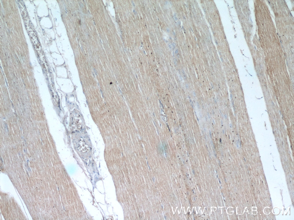 IHC staining of human skeletal muscle using 55281-1-AP