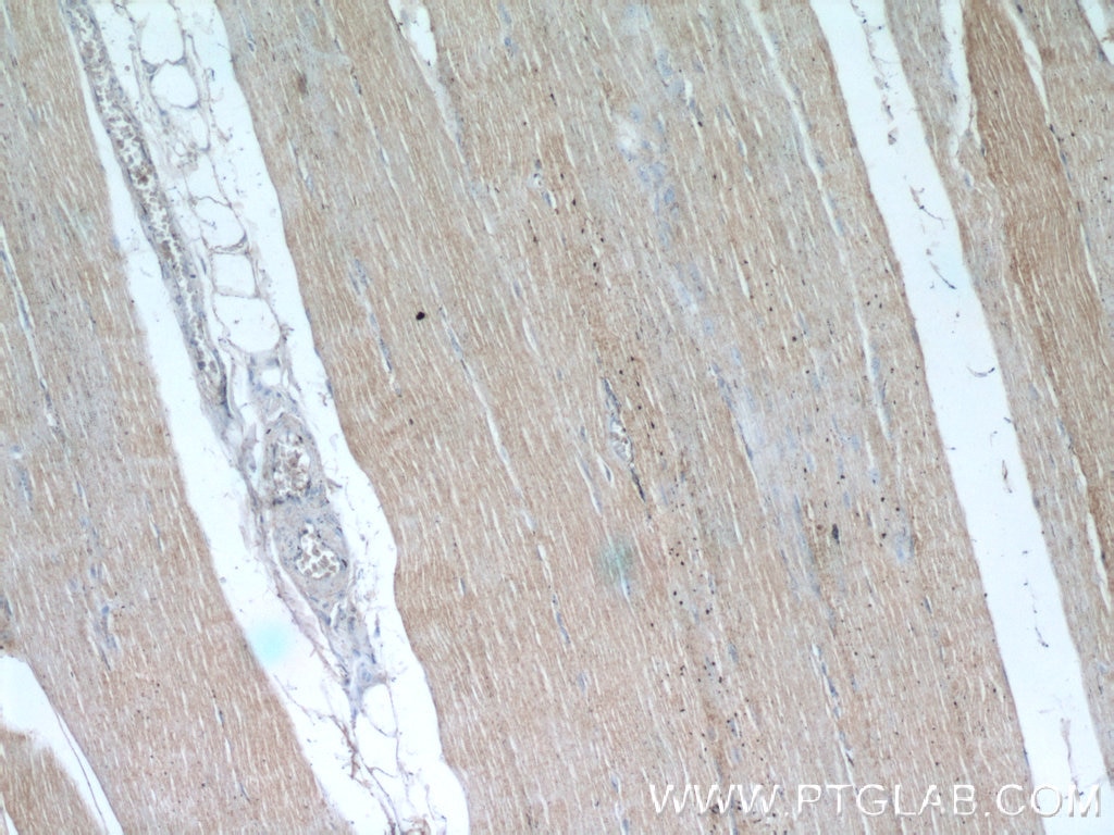 Immunohistochemistry (IHC) staining of human skeletal muscle tissue using OBSCN Polyclonal antibody (55281-1-AP)