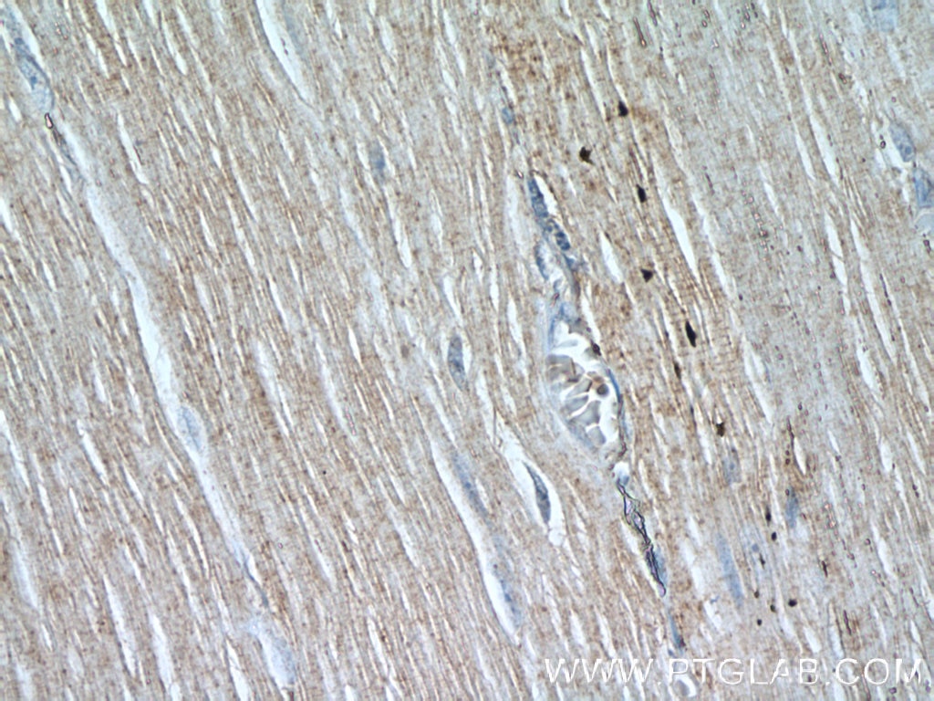 Immunohistochemistry (IHC) staining of human skeletal muscle tissue using OBSCN Polyclonal antibody (55281-1-AP)
