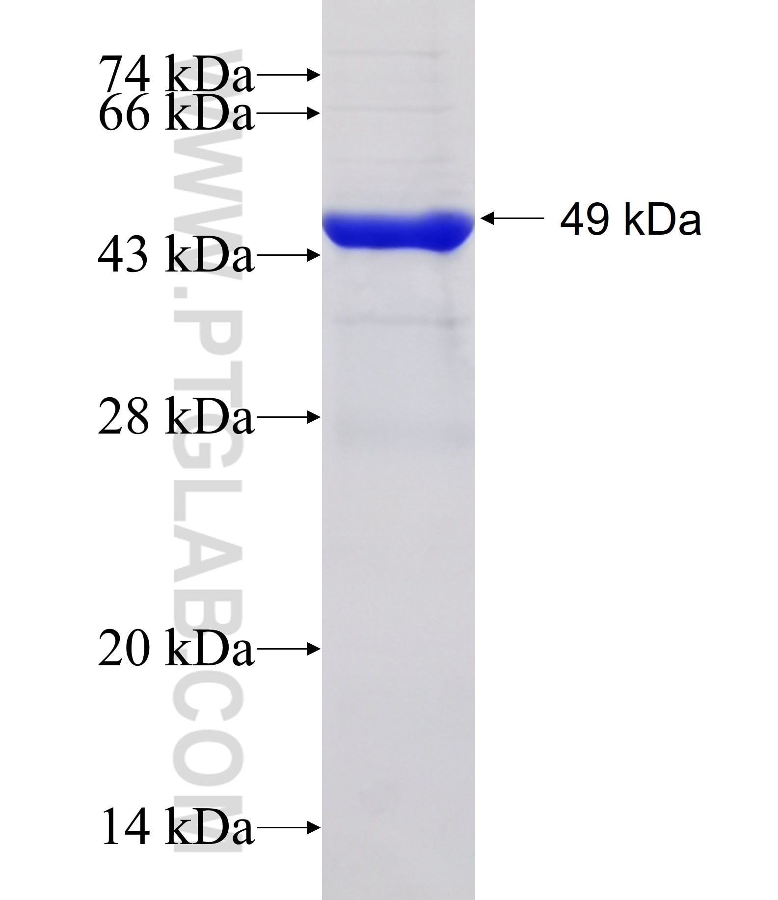 OBSL1 fusion protein Ag31774 SDS-PAGE OBSL1 fusion protein Ag31774 SDS-PAGE