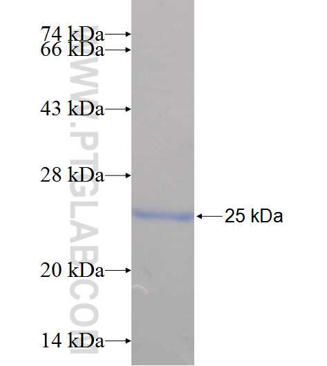 OCA2 fusion protein Ag24841 SDS-PAGE