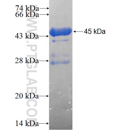 OCA2 fusion protein Ag24864 SDS-PAGE