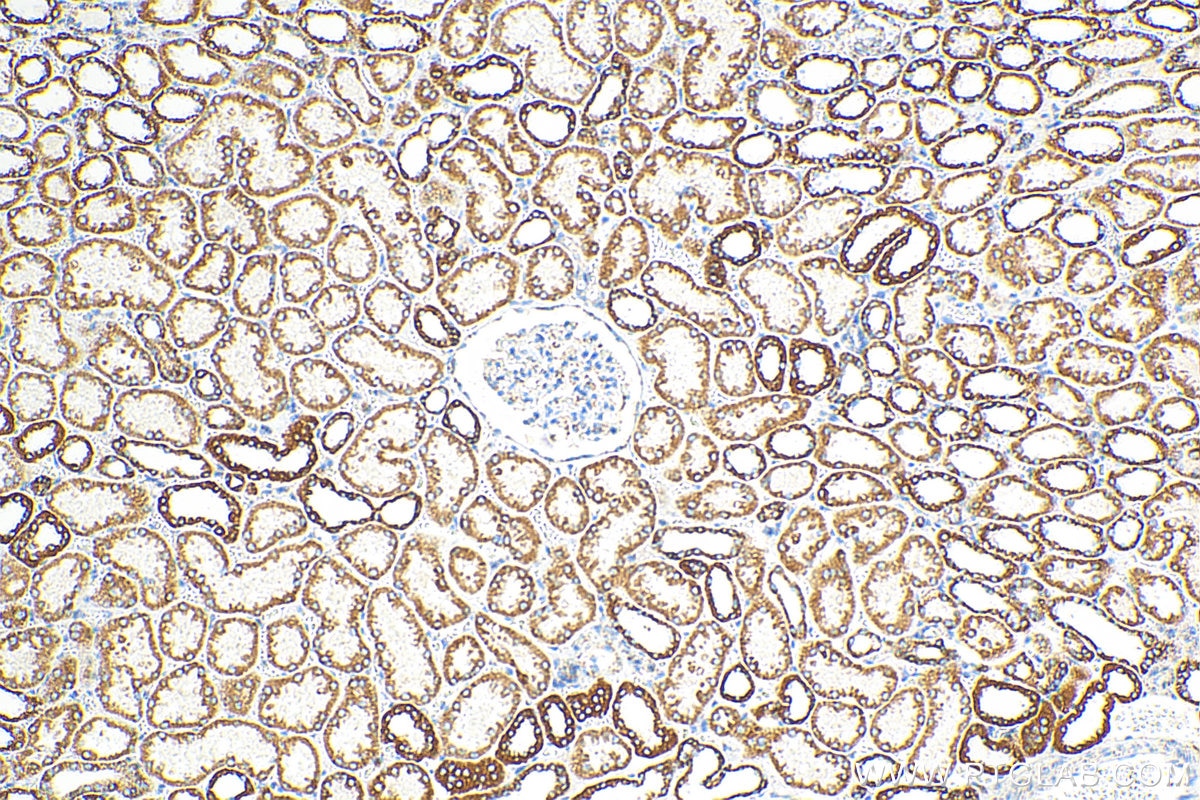 Immunohistochemistry (IHC) staining of human kidney tissue using OCIAD1 Polyclonal antibody (16634-1-AP)