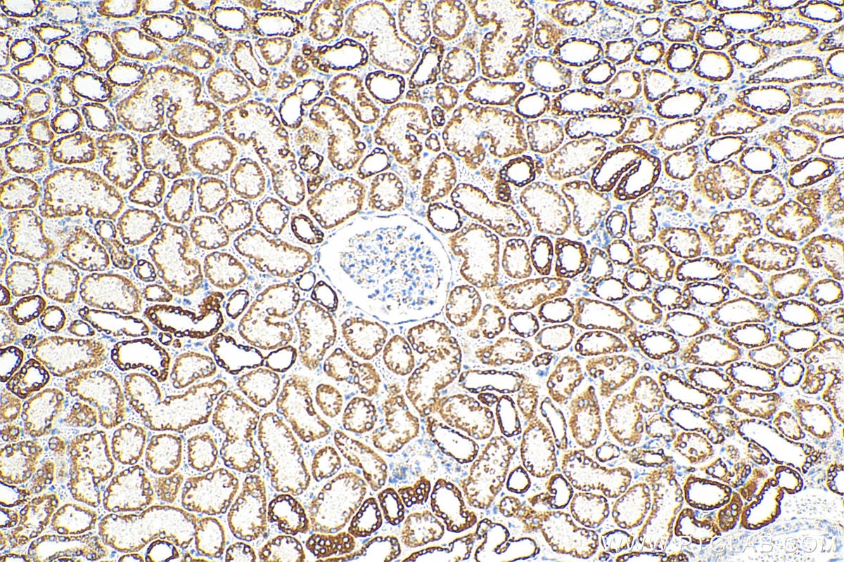 Immunohistochemistry (IHC) staining of human kidney tissue using OCIAD1 Polyclonal antibody (16634-1-AP)
