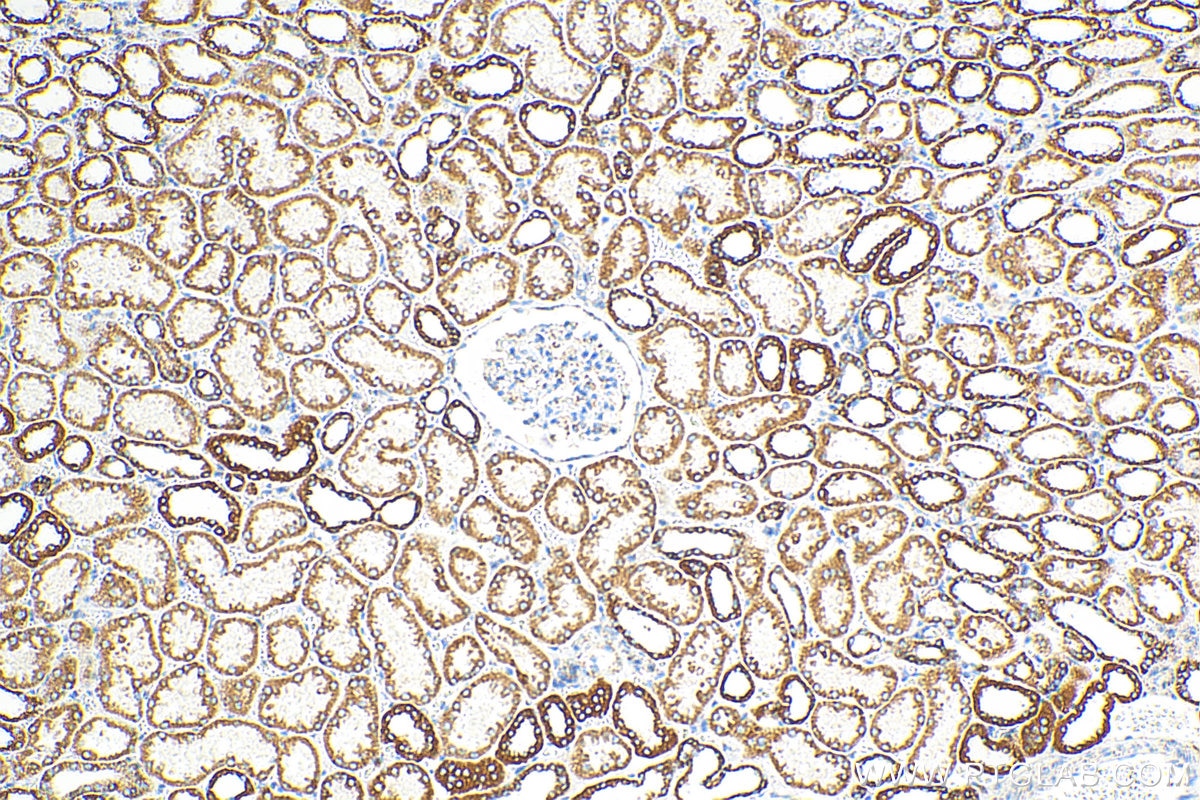 IHC staining of human kidney using 16634-1-AP