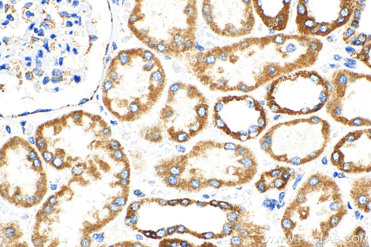 IHC staining of human kidney using 16634-1-AP