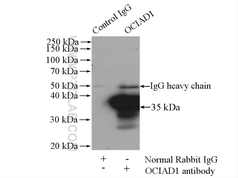 IP experiment of HeLa using 16634-1-AP