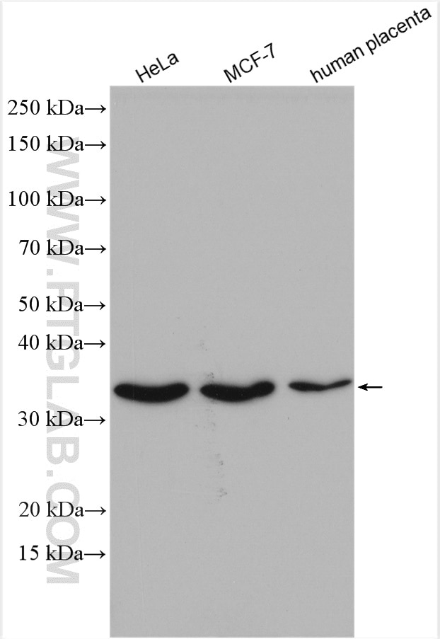 Western Blot (WB) analysis of various lysates using OCIAD1 Polyclonal antibody (16634-1-AP)