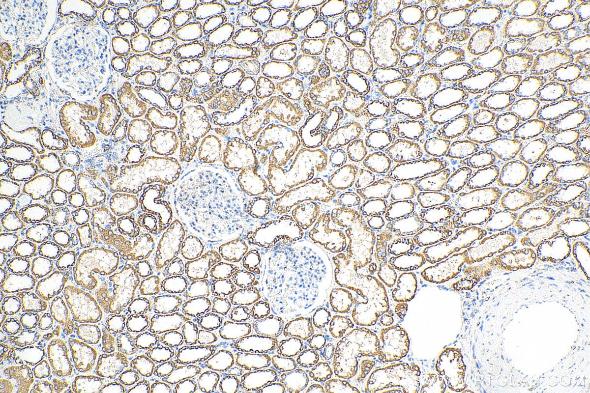 Immunohistochemistry (IHC) staining of human kidney tissue using OCIAD1 Monoclonal antibody (66698-1-Ig)