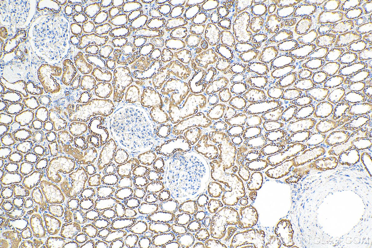 Immunohistochemistry (IHC) staining of human kidney tissue using OCIAD1 Monoclonal antibody (66698-1-Ig)