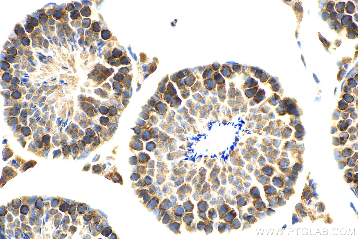 Immunohistochemistry (IHC) staining of mouse testis tissue using OCIAD1 Monoclonal antibody (66698-1-Ig)