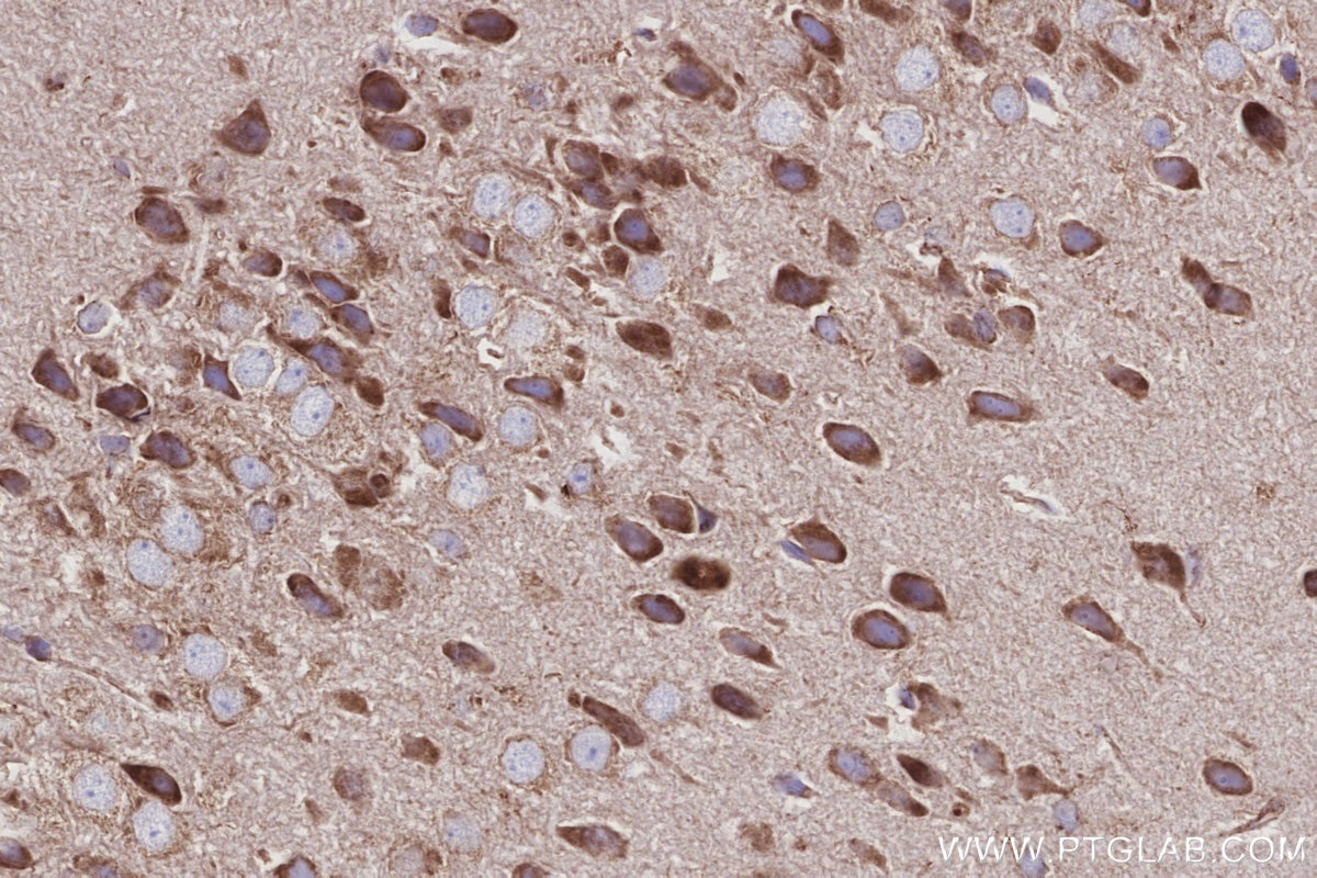 IHC staining of mouse brain using 66698-1-Ig Immunohistochemistry (IHC) staining of mouse brain tissue using OCIAD1 Monoclonal antibody (66698-1-Ig)