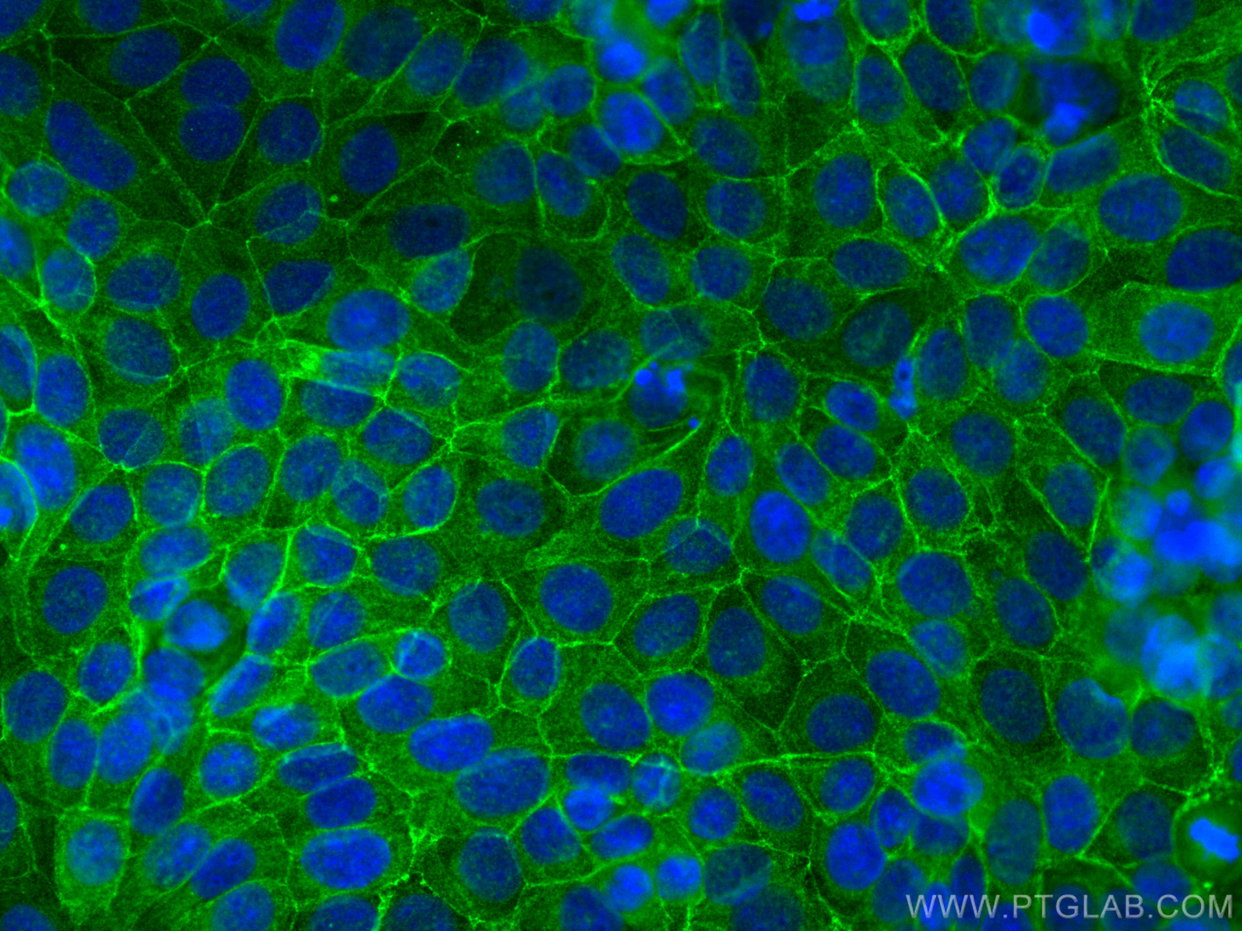 Immunofluorescence (IF) / fluorescent staining of MCF-7 cells using Occludin Polyclonal antibody (13409-1-AP)