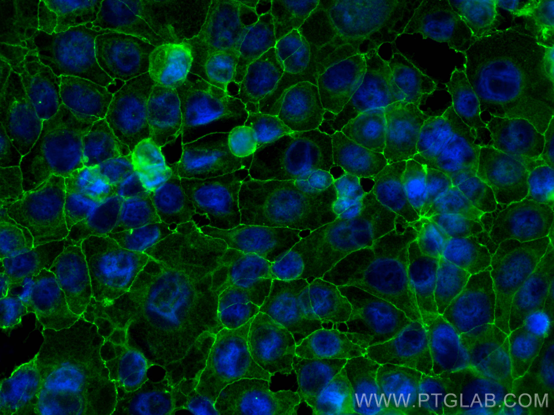 Immunofluorescence (IF) / fluorescent staining of MCF-7 cells using Occludin Polyclonal antibody (13409-1-AP)