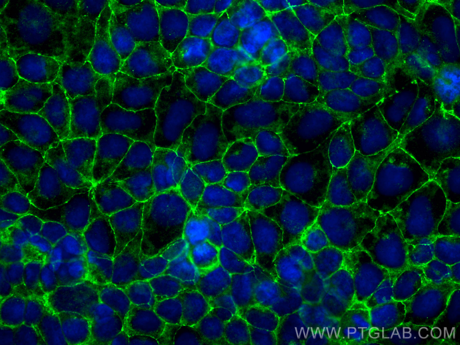 IF Staining of Caco-2 using 13409-1-AP Immunofluorescence (IF) / fluorescent staining of Caco-2 cells using Occludin Polyclonal antibody (13409-1-AP)