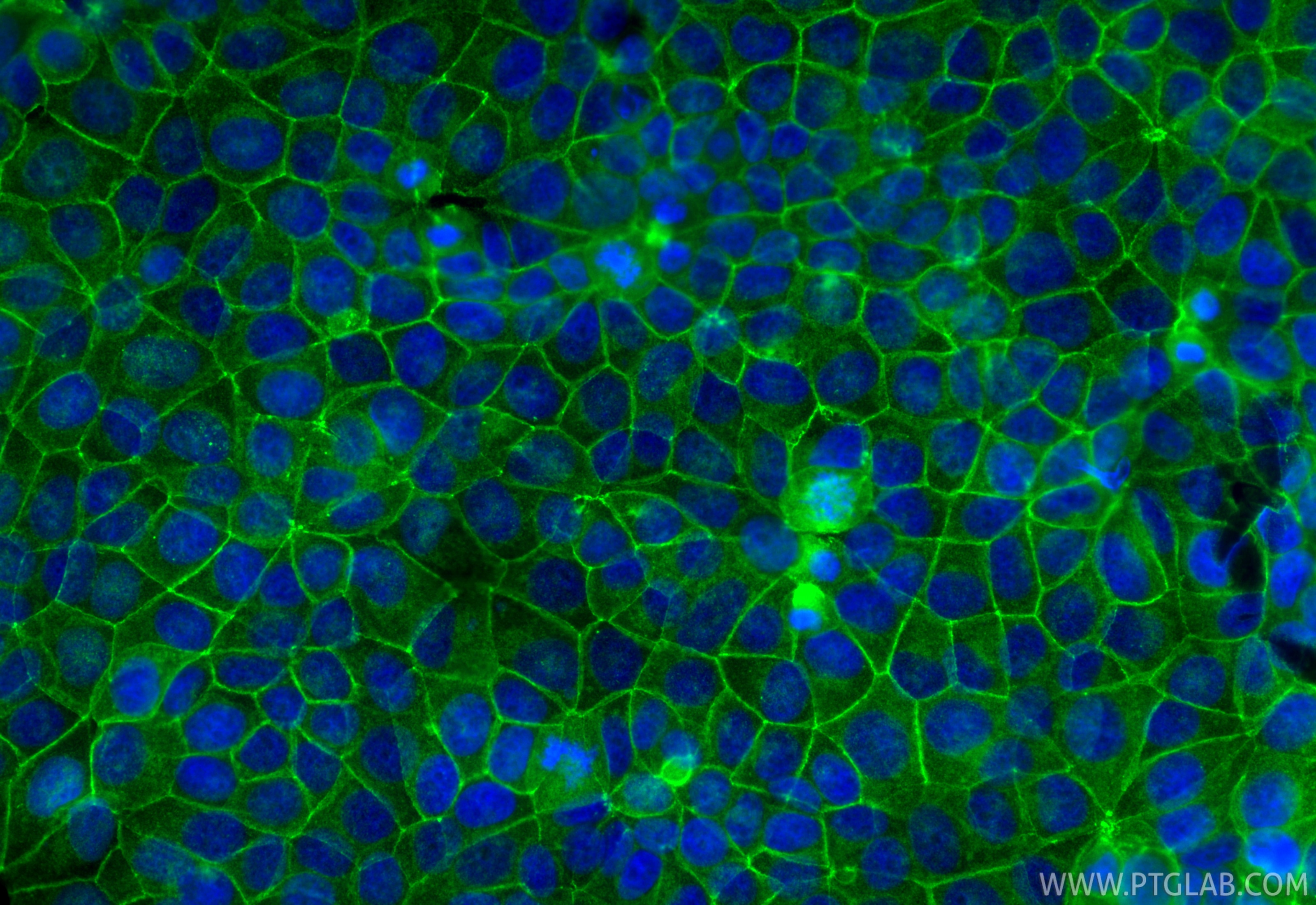 IF Staining of MCF-7 using 13409-1-AP Immunofluorescence (IF) / fluorescent staining of MCF-7 cells using Occludin Polyclonal antibody (13409-1-AP)